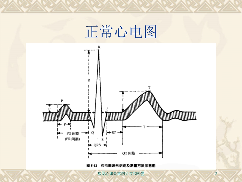 常见心律失常的诊疗和处置培训课件.ppt_第2页