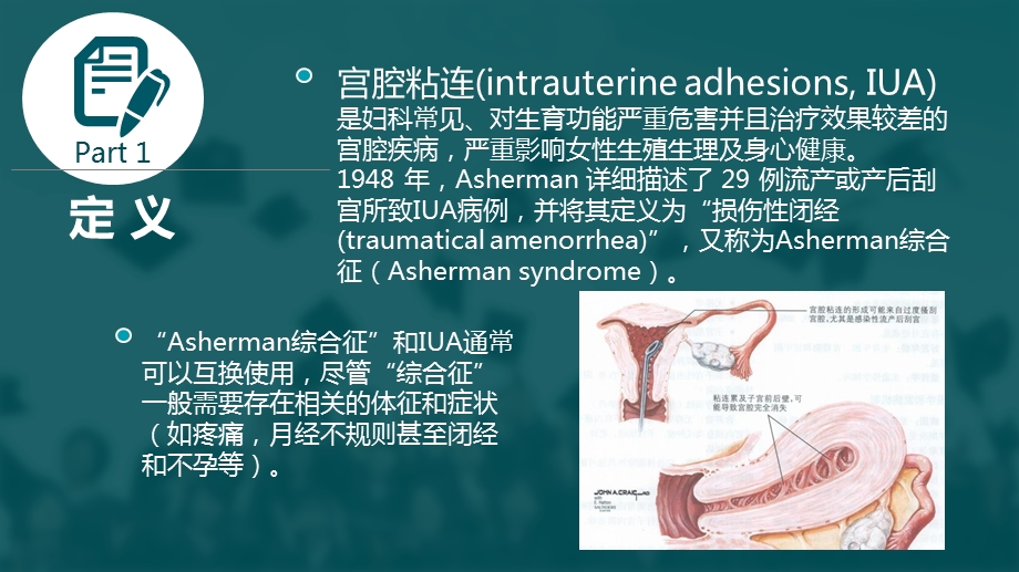 宫腔粘连临床诊疗和指南课件.ppt_第2页