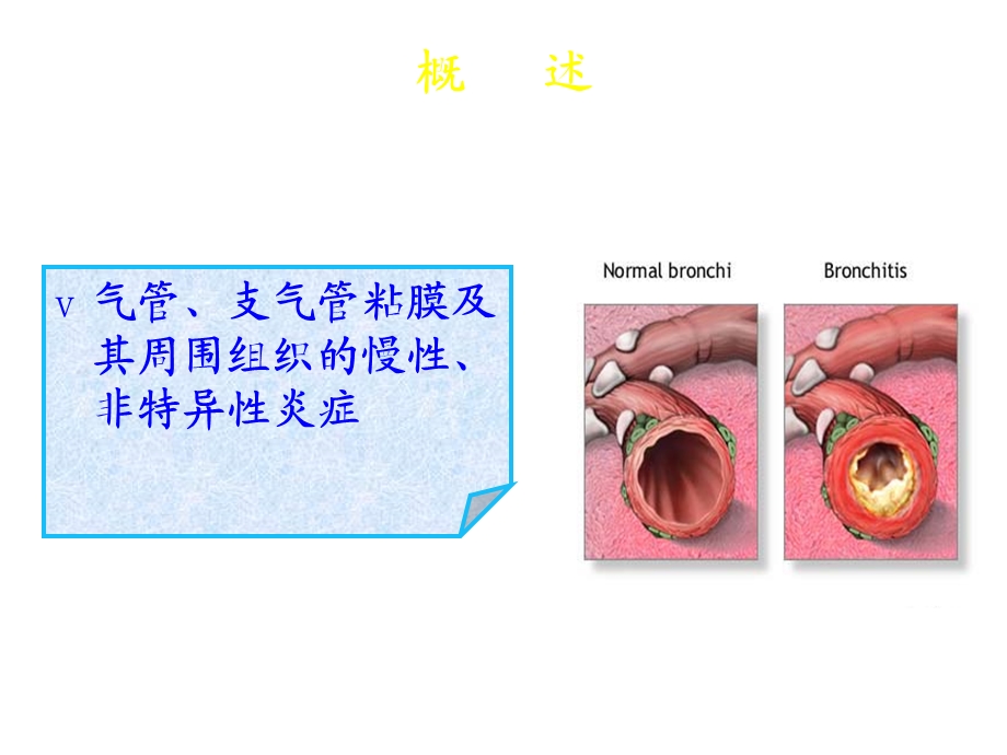 慢性支气管炎病人的护理课件.ppt_第3页