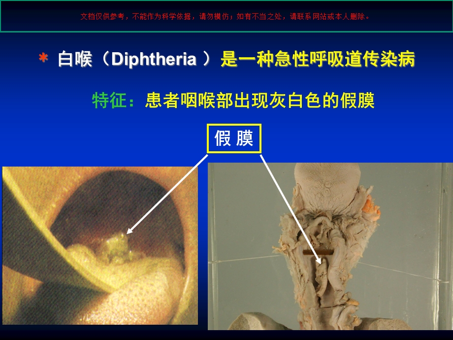 棒状杆菌属专题培训培训课件.ppt_第3页