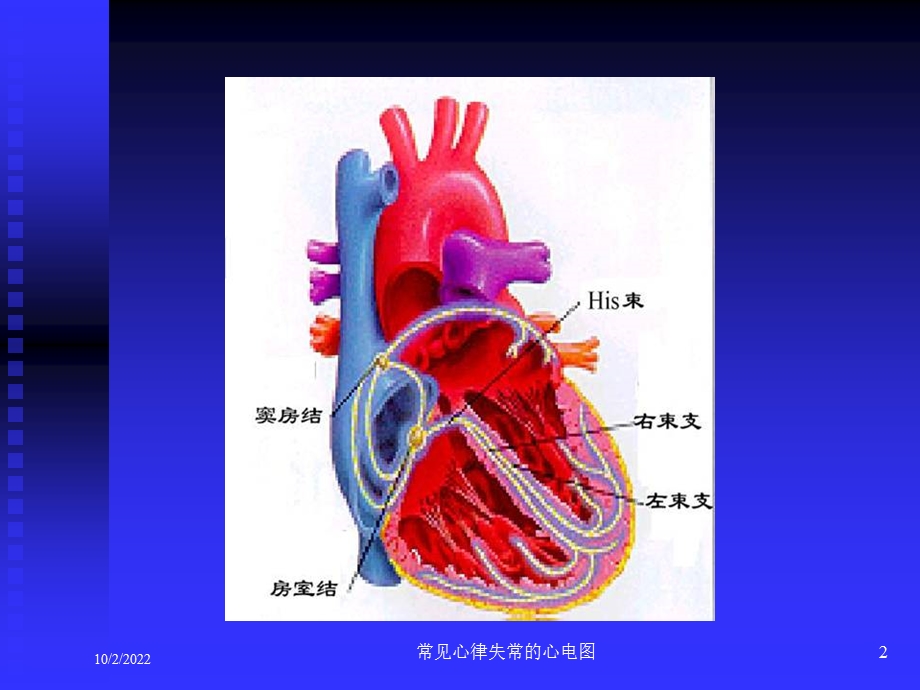 常见心律失常的心电图课件.ppt_第2页