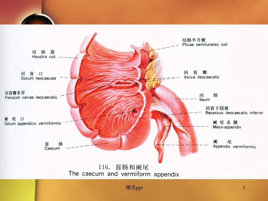 急性阑尾炎病人的护理59684课件.ppt_第3页