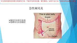 急性阑尾炎专题知识宣教培训课件.ppt