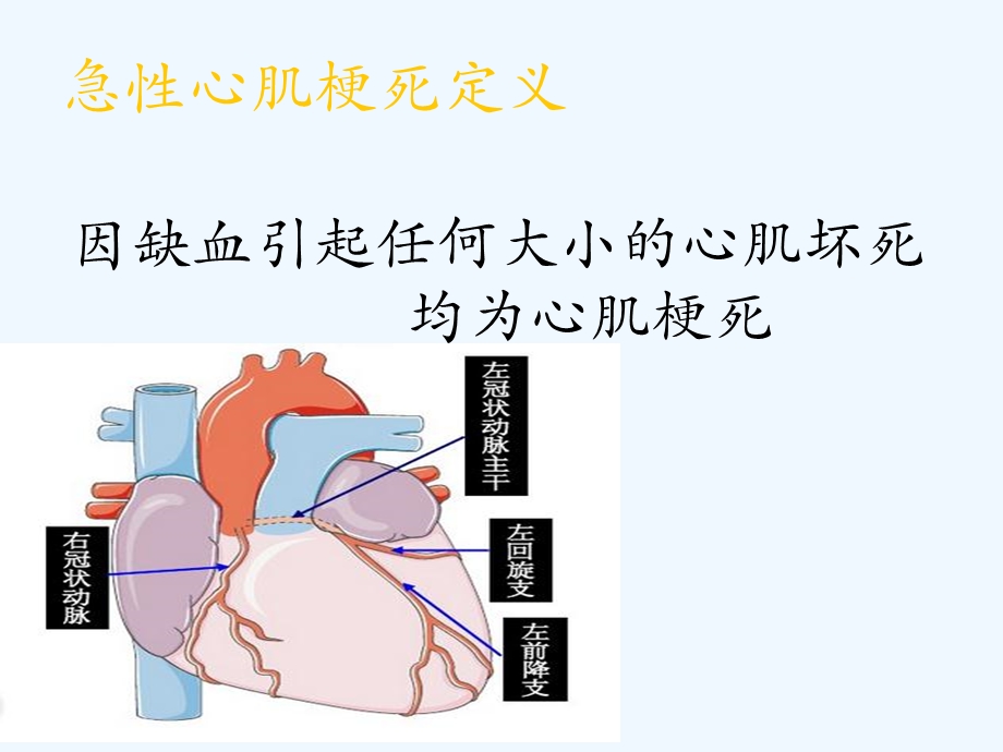 急性心肌梗死的溶栓治疗教学查房课件.ppt_第2页