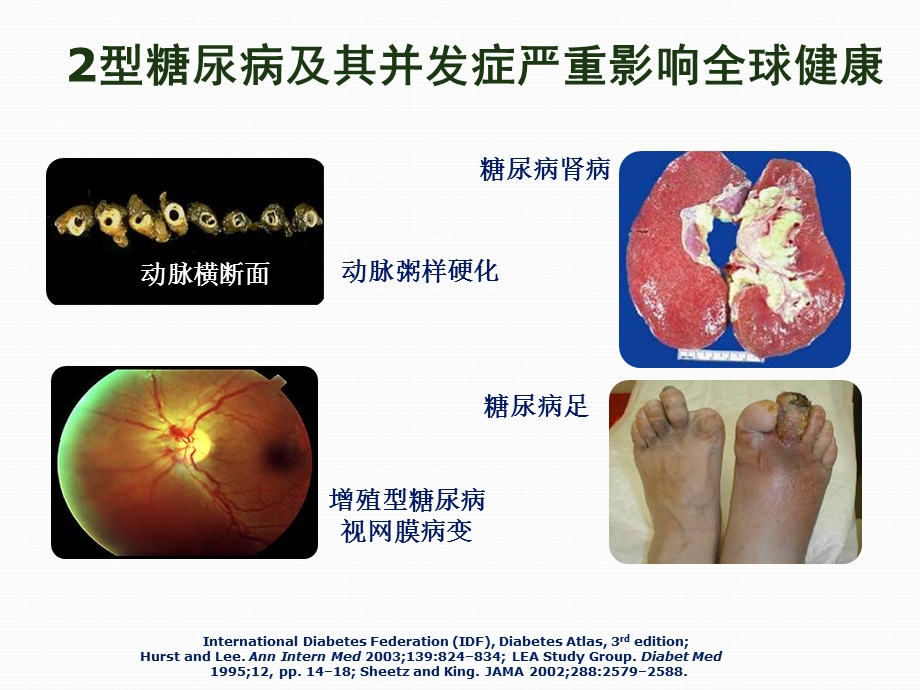 常用胰岛素分类ppt课件.pptx_第3页