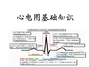 心电图讲课稿ppt课件.ppt