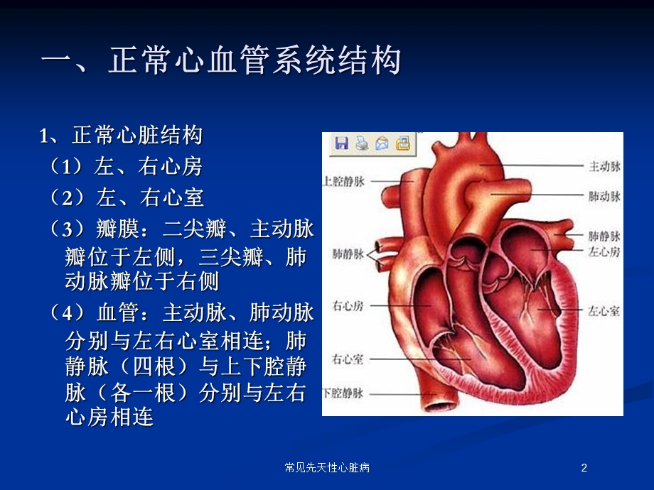 常见先天性心脏病培训课件.ppt_第2页