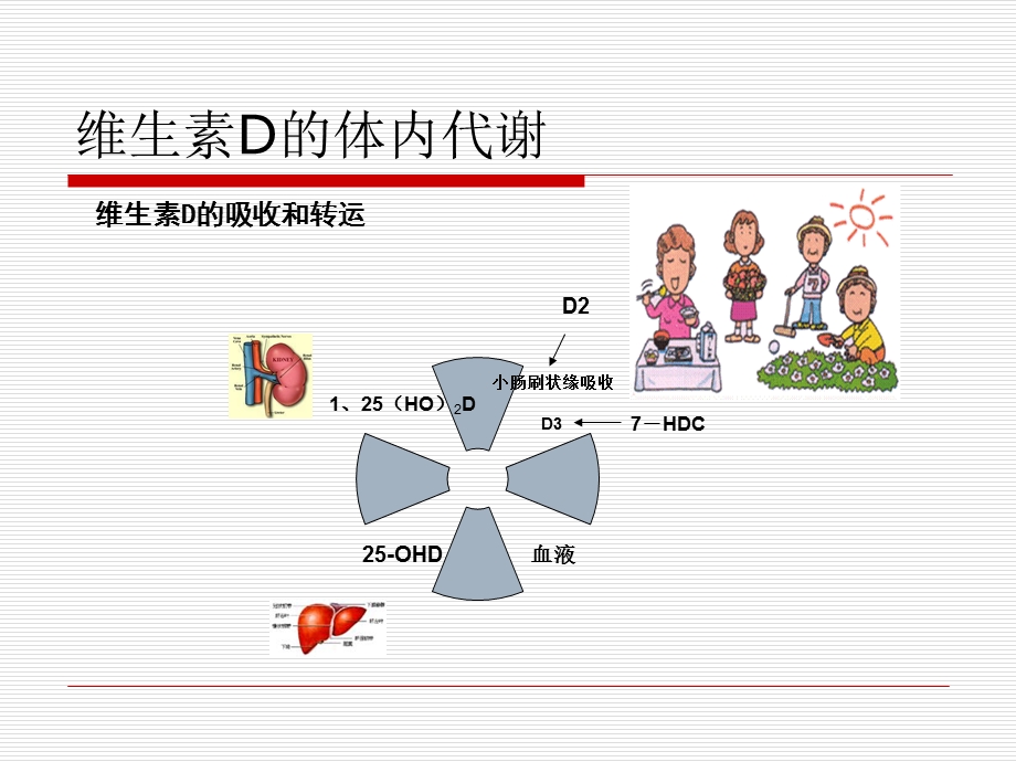 小儿佝偻病的护理ppt课件.ppt_第3页