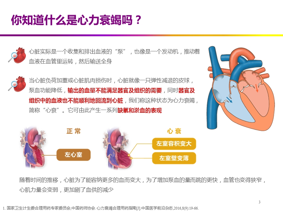 心衰患教疾病管理篇ppt医学课件.pptx_第3页