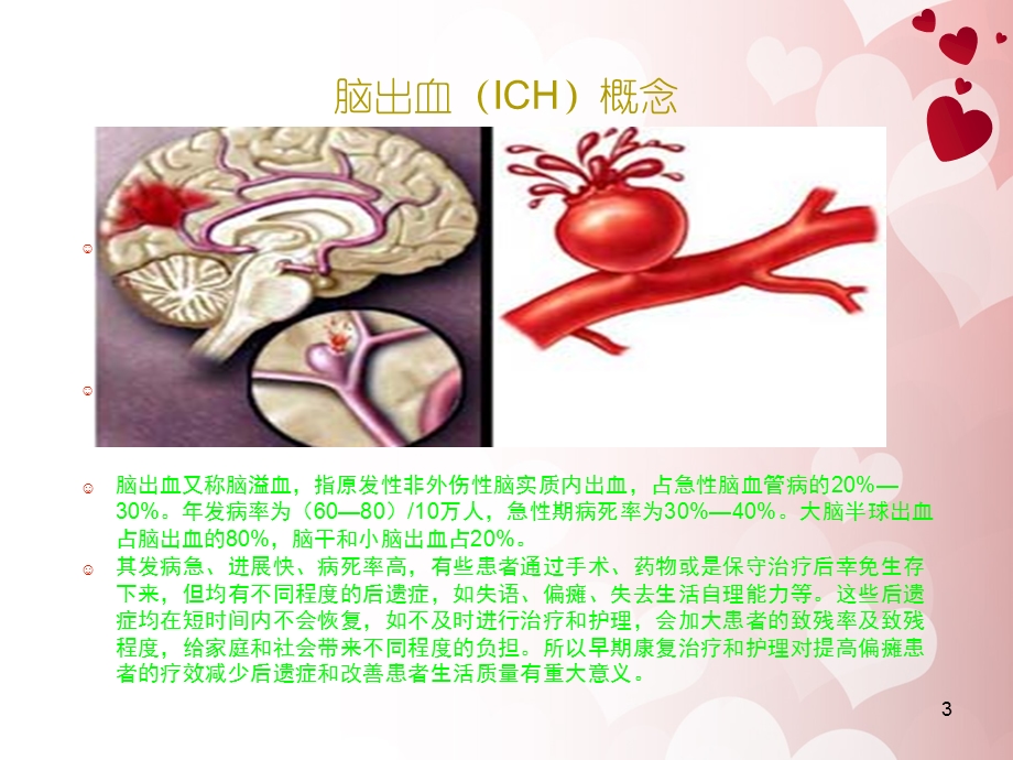 康复科业务查房课件.ppt_第3页