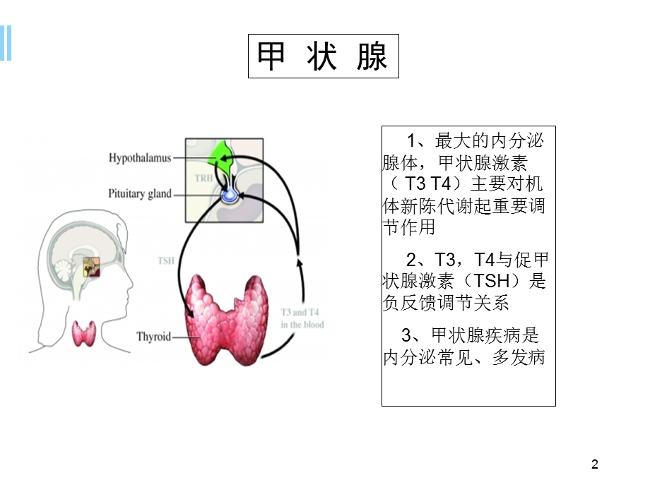 常见甲状腺疾病的诊疗要点学习课件.ppt_第2页