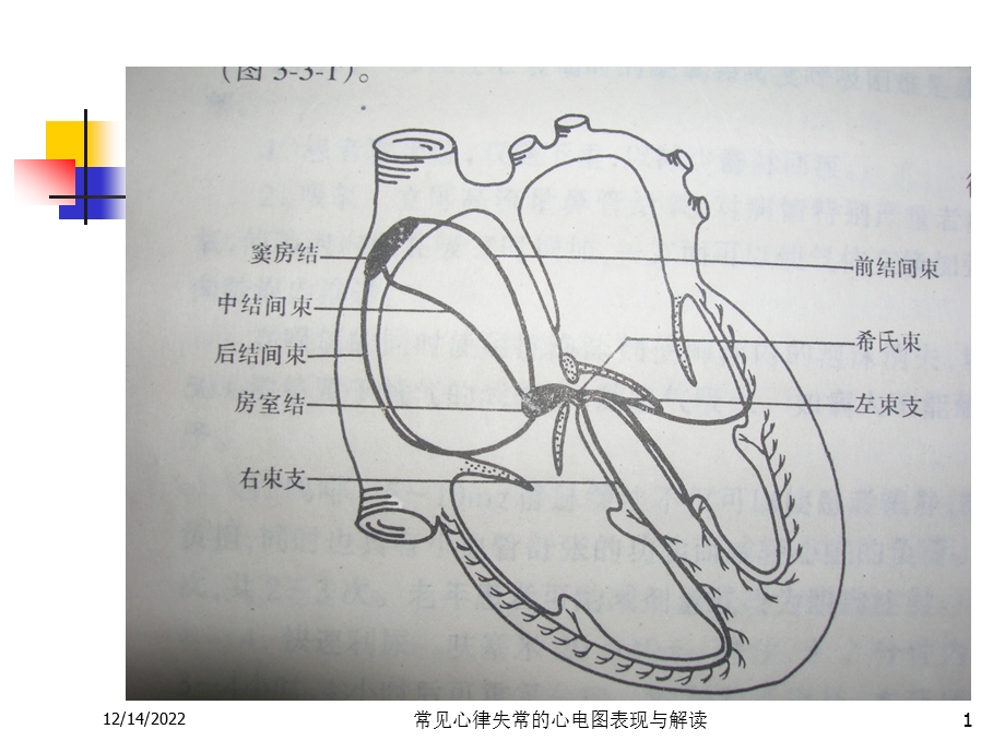 常见心律失常的心电图表现与解读培训课件.ppt_第1页