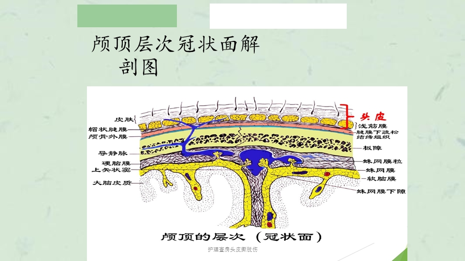 护理查房头皮撕脱伤课件.ppt_第3页