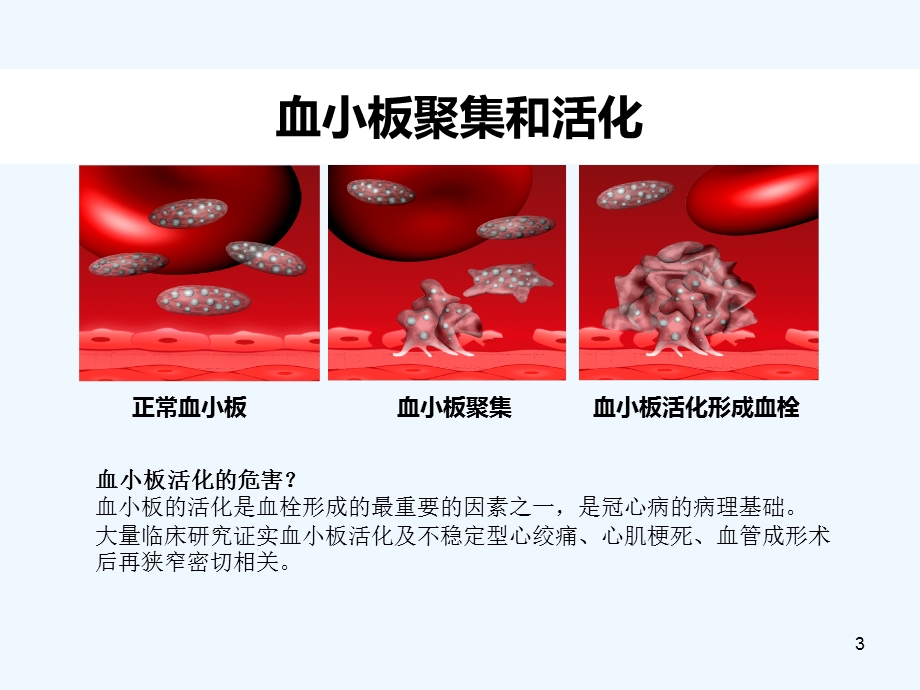 抗血小板活化临床应用课件.ppt_第3页