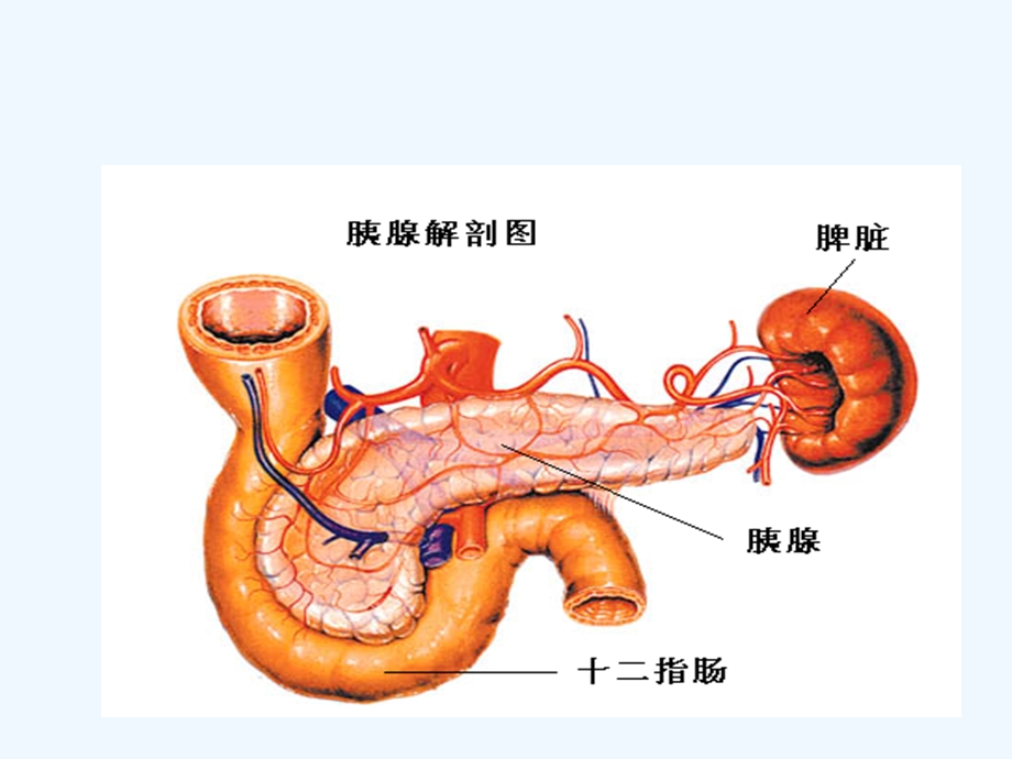 急性重症胰腺炎的护理课件.ppt_第2页