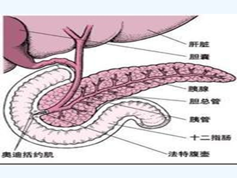 急性重症胰腺炎的护理课件.ppt_第3页