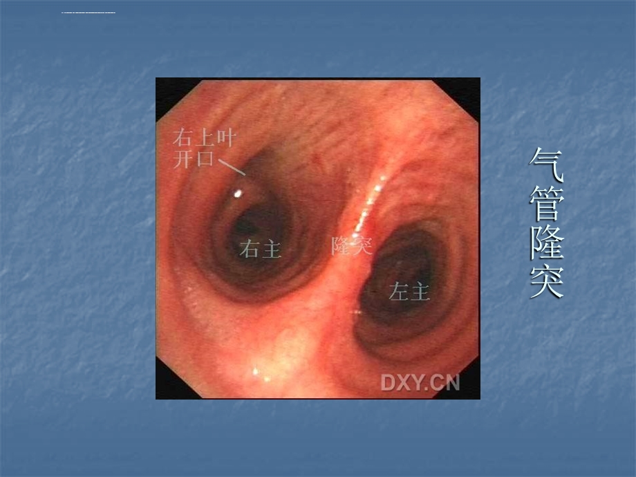 支气管镜图谱ppt课件.ppt_第3页