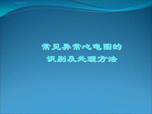 常见异常心电图的识别及处理ppt课件.ppt