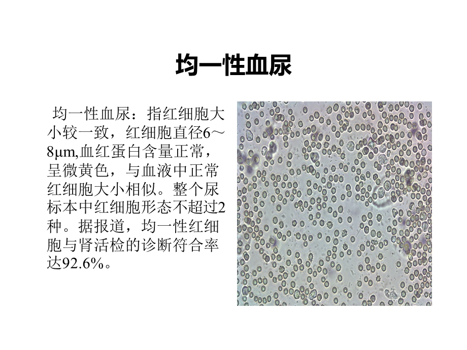 尿液红细胞位相课件.pptx_第3页