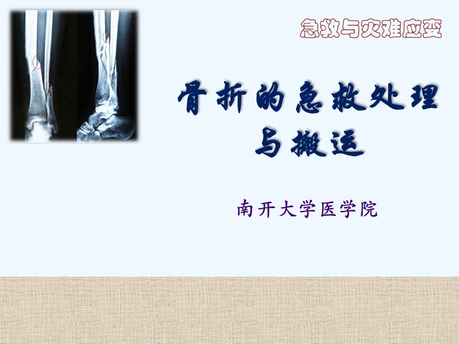 急救骨折急救处理与搬运课件.ppt_第1页