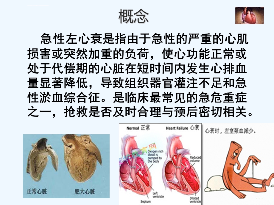 急性左心衰的急救护理ppt课件.ppt_第3页