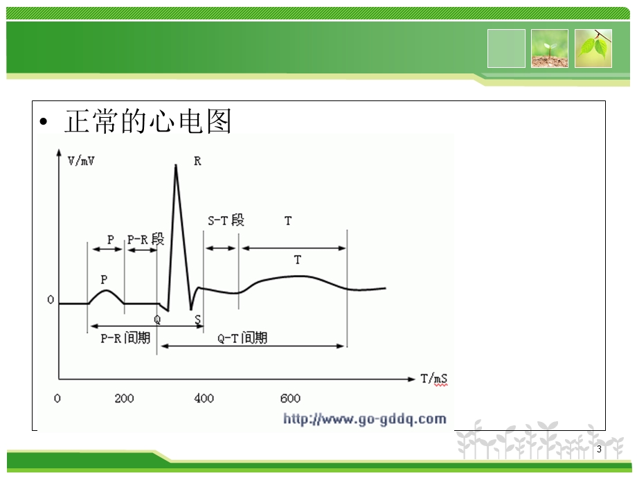 房颤的心电图诊断学习课件.ppt_第3页