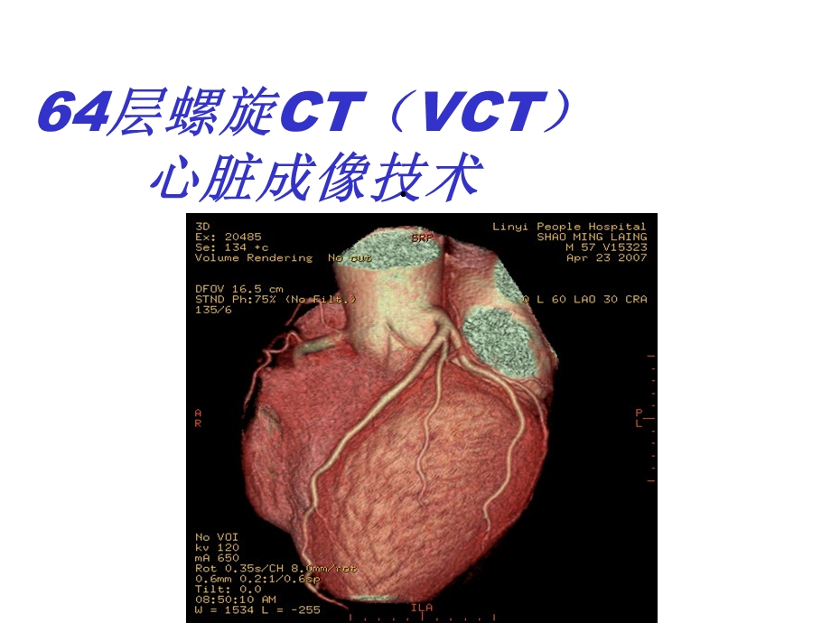 排螺旋CT心脏成像技术课件.ppt_第1页