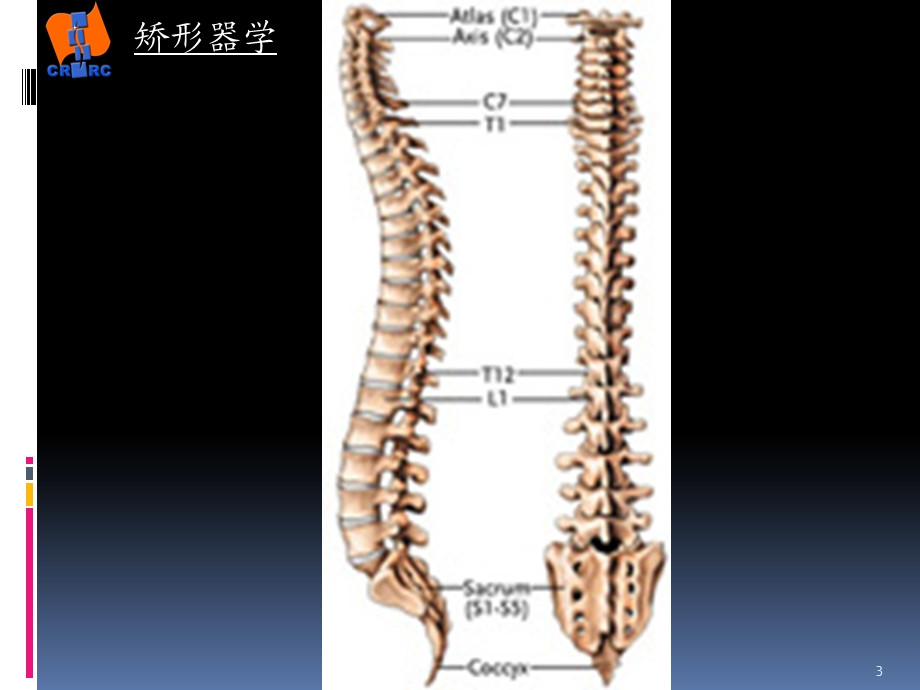 常见脊柱畸形参考课件.ppt_第3页