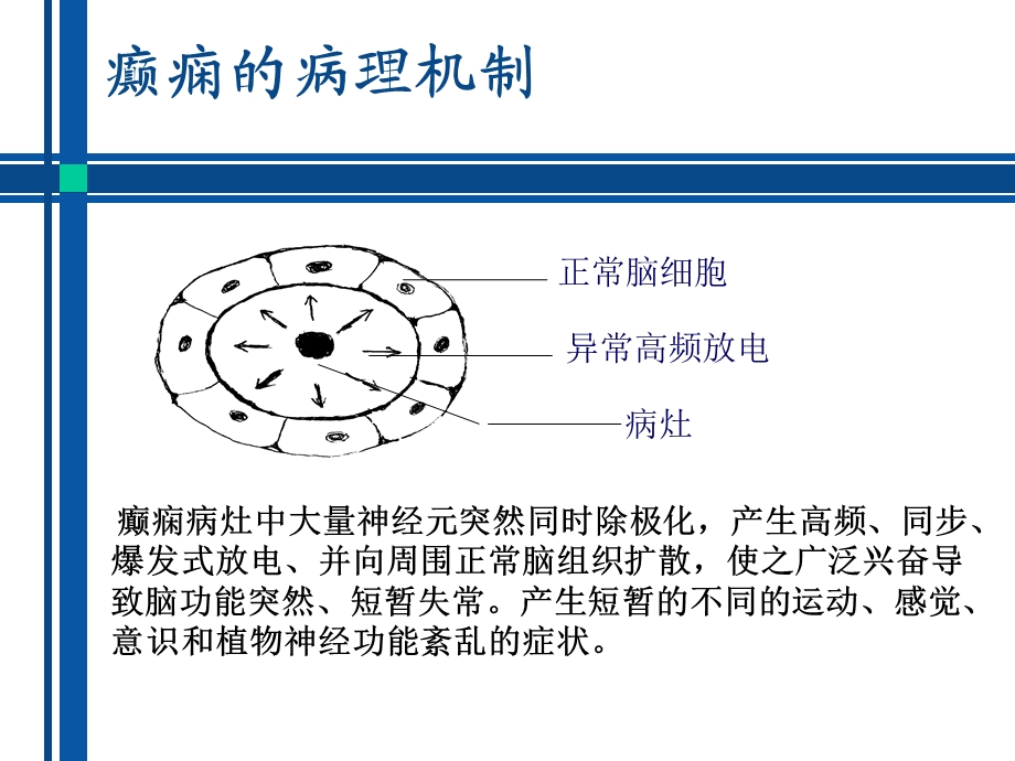 抗癫痫药物介绍课件.ppt_第3页