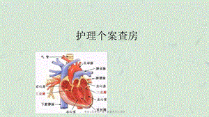 急性心肌梗死护理个案查房东九归纳课件.ppt