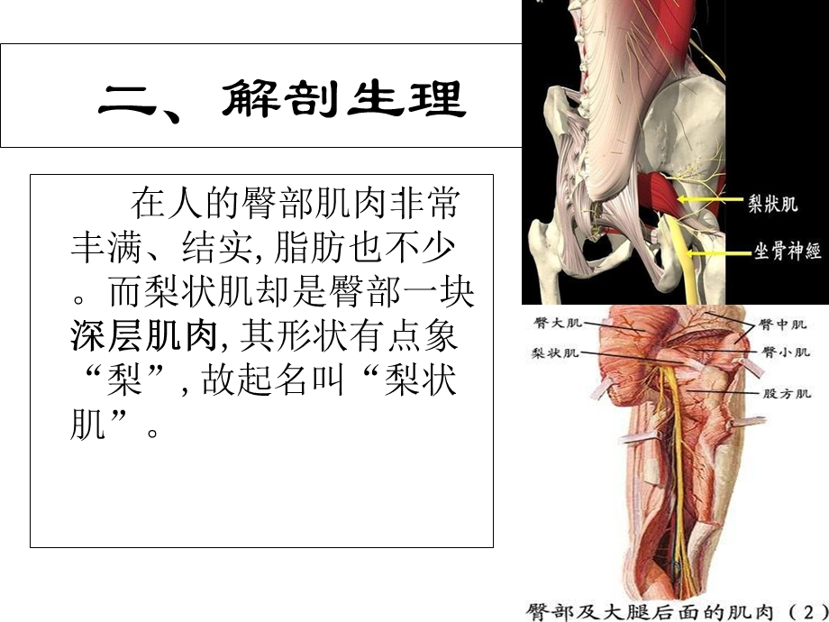 梨状肌综合征课件.ppt_第3页