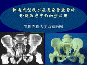 快速成型技术在复杂骨盆骨折诊断治疗中的初步应用课件.pptx