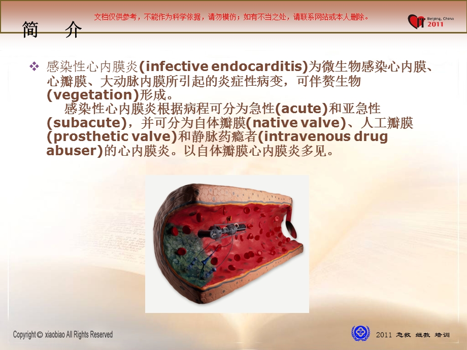 感染性心内膜炎诊治现状课件.ppt_第1页