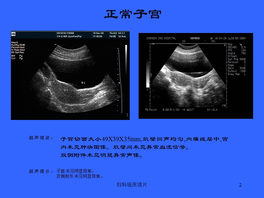 妇科临床读片培训课件.ppt_第2页