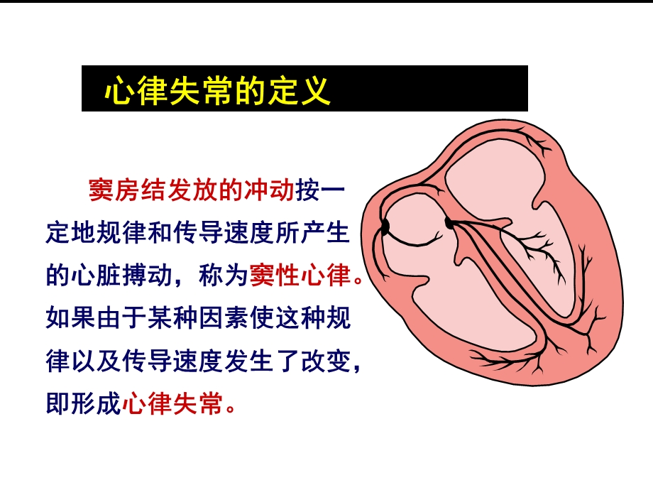 常见心律失常诊断与治疗ppt课件.ppt_第2页