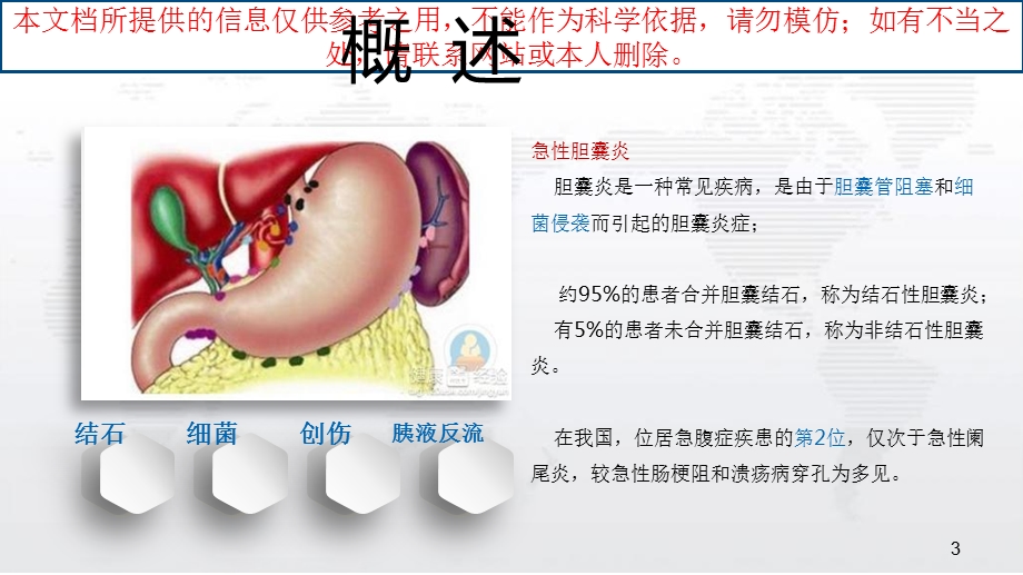 急性胆囊炎汇总培训课件.ppt_第3页