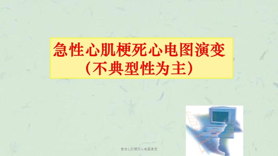 急性心肌梗死心电图演变课件.ppt_第1页