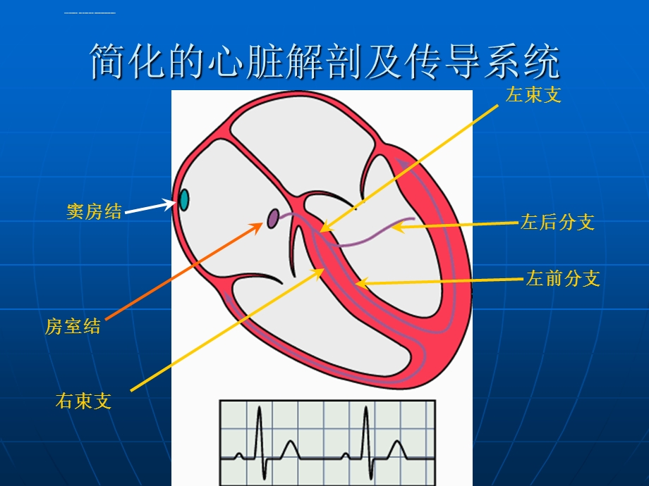 恶性心律失常的诊断及电复律ppt课件.ppt_第3页