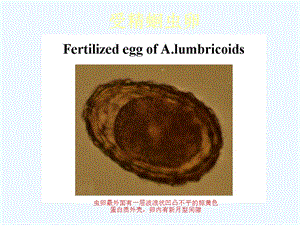 寄生虫标本考试图谱必考部分课件.ppt