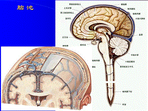 断层解剖脑池脑血管课件.ppt