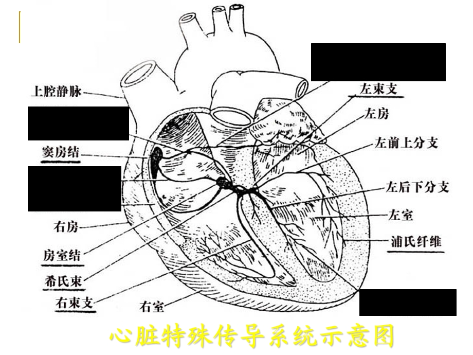 常见异常心电图的鉴别与诊断技巧ppt课件.ppt_第2页