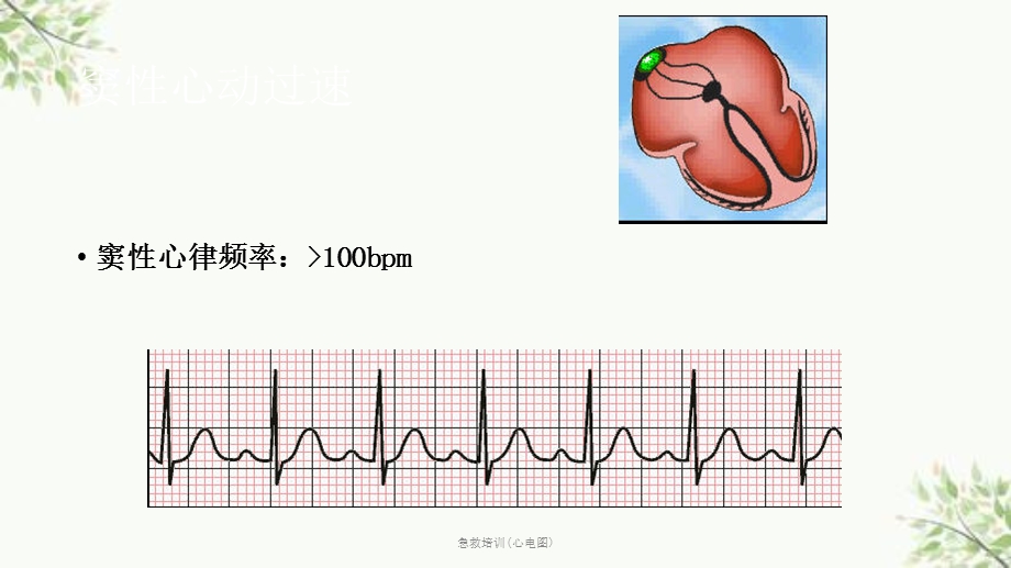 急救培训(心电图)课件.ppt_第3页