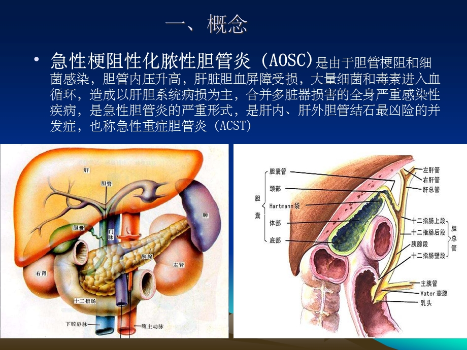 急性梗阻性化脓性胆管炎版本课件.ppt_第2页