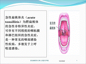 急性扁桃体炎病人的医疗护理培训课件.ppt