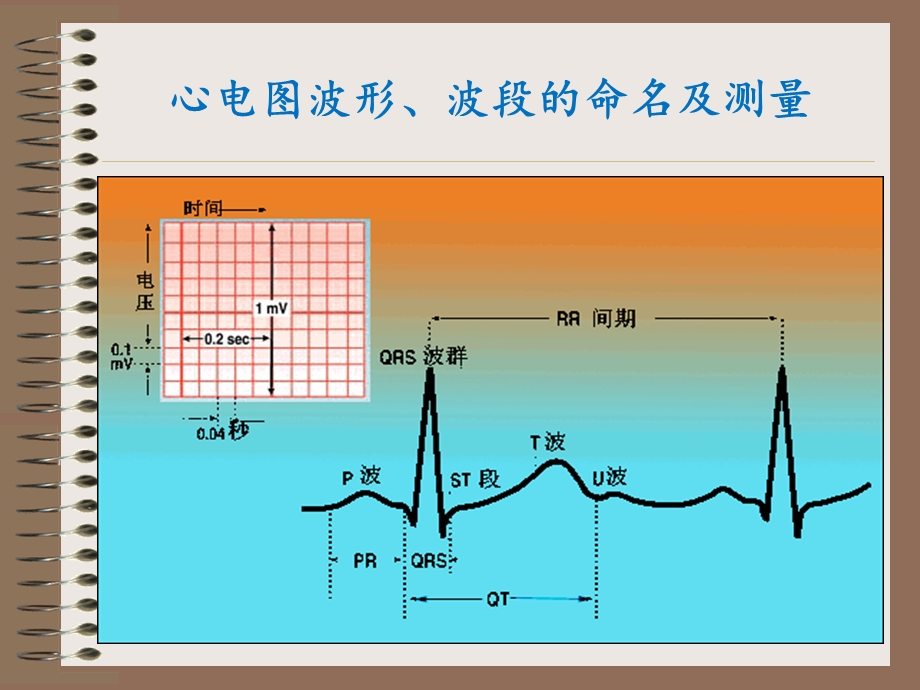 常见心电图识别课件.pptx_第3页