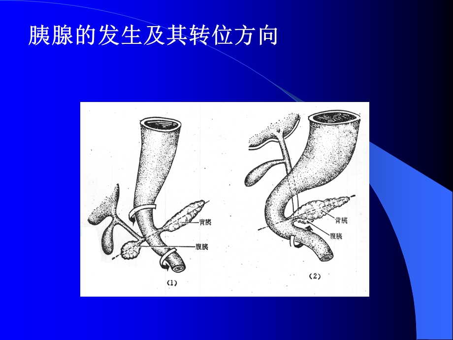 急性胰腺炎ppt课件.ppt_第3页