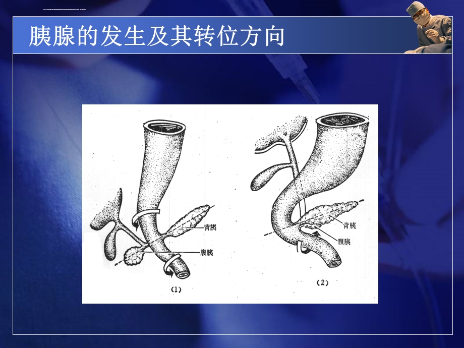 急性胰腺炎夏金荣ppt课件.ppt_第3页