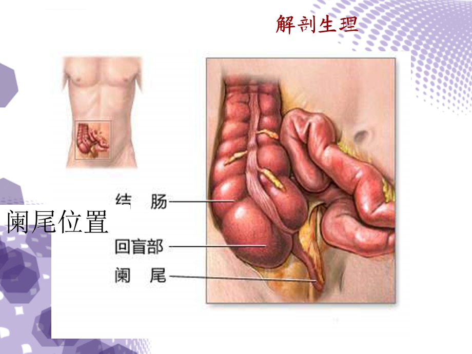 急性阑尾炎超声诊断ppt课件.ppt_第3页