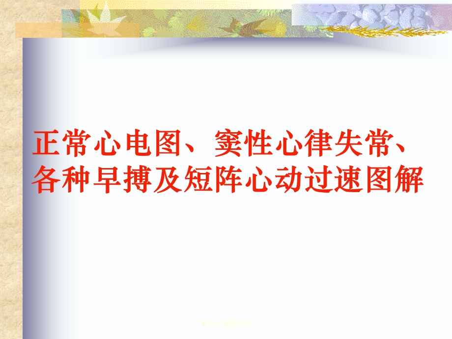 常见心电图诊疗培训课件.ppt_第2页