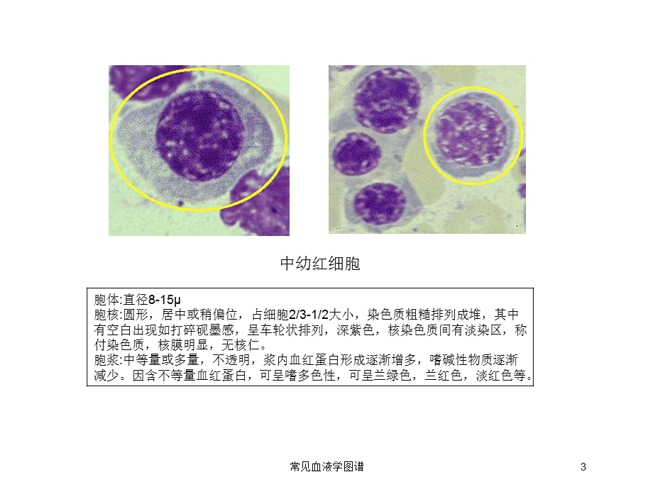 常见血液学图谱培训课件.ppt_第3页